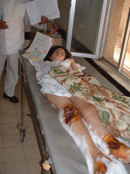 iraq war: injured girl
