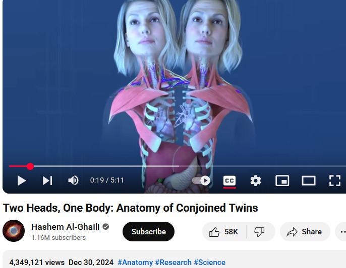 Abby and Brittany Hensel anatomy 2025-09-02 13cd2